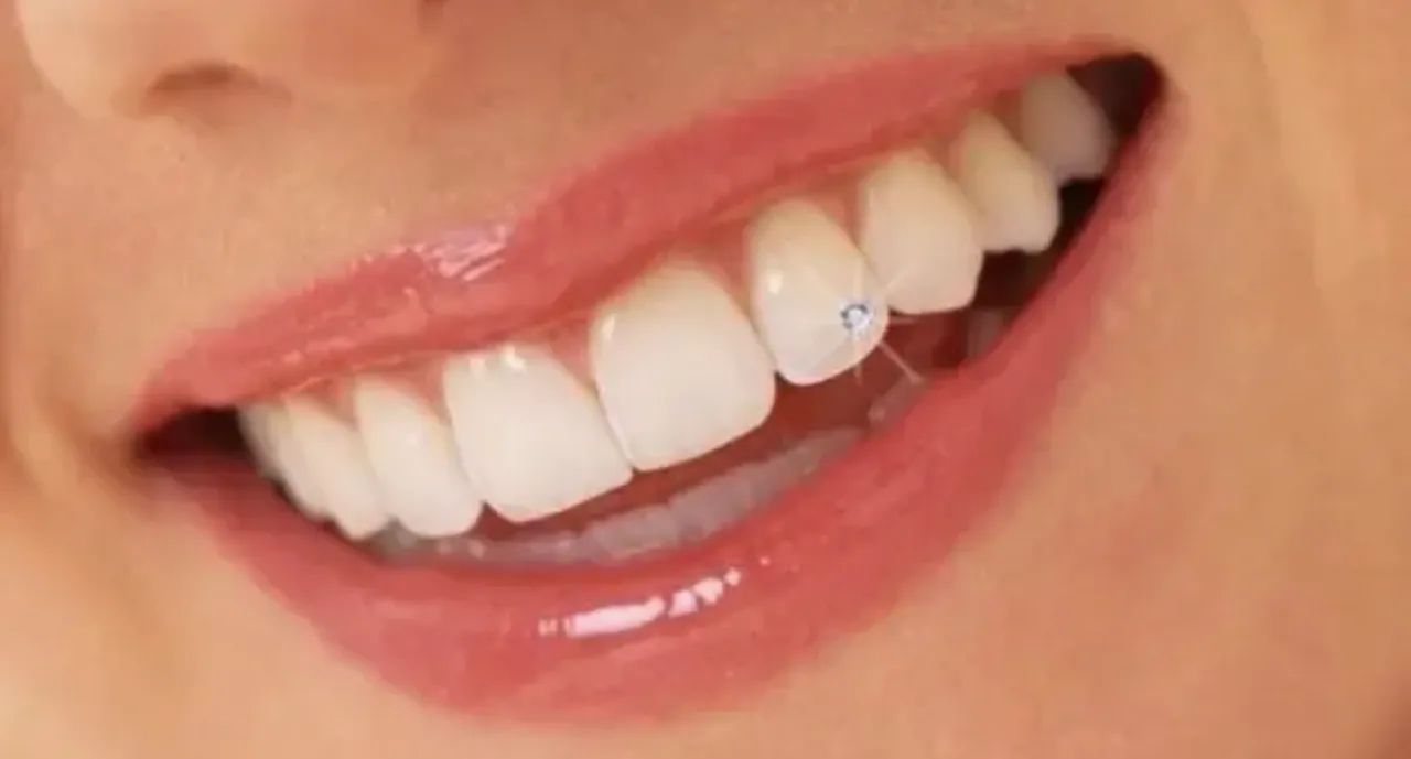 Piercing dente 7 unidades 