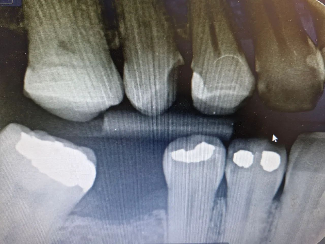 Radiografias odontológicos que cabem no seu orçamento.  - Foto 4