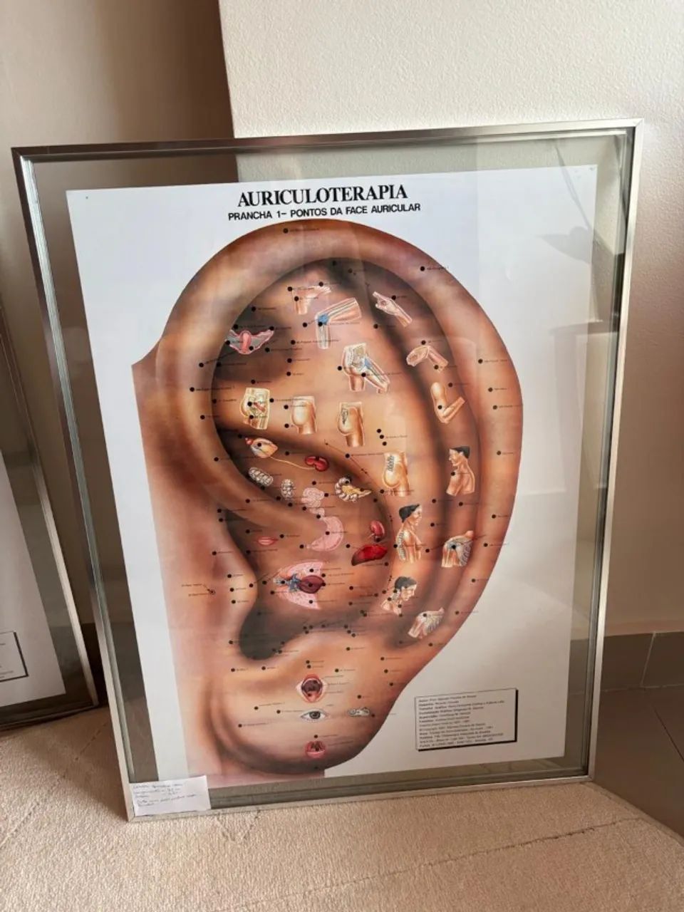 Quadro de Pontos para Auriculoterapia - Foto 2