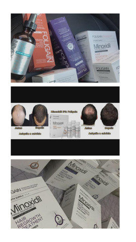 Minoxidil extra forte foligain 5% 60 ml Original - Foto 2