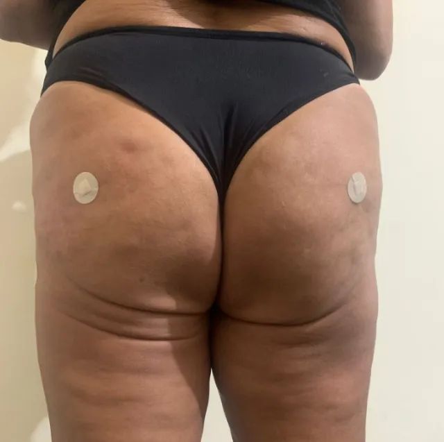 gluteo - Foto 2
