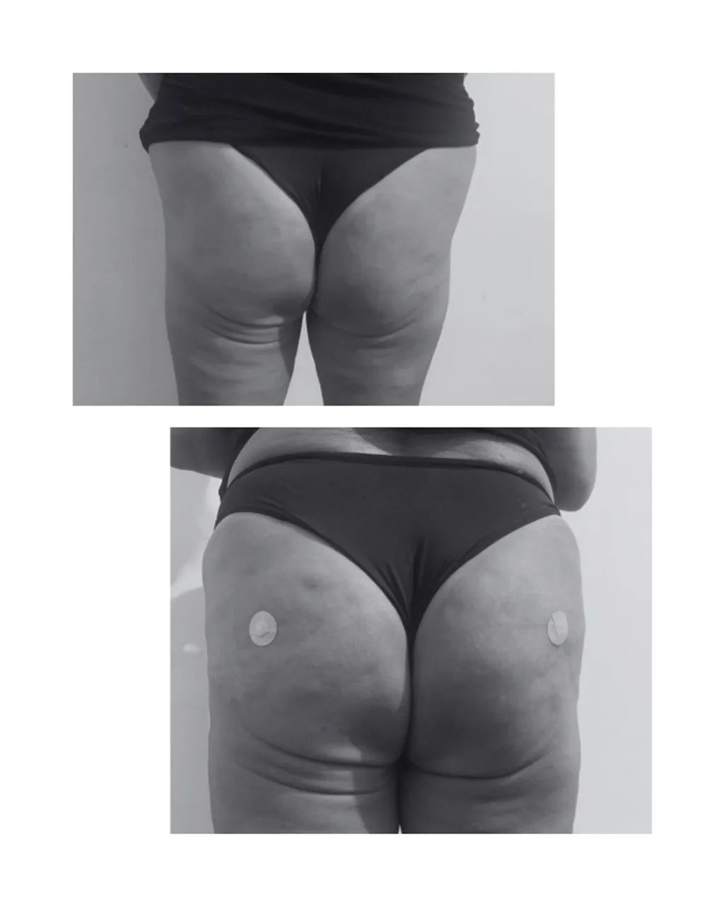 gluteo - Foto 4