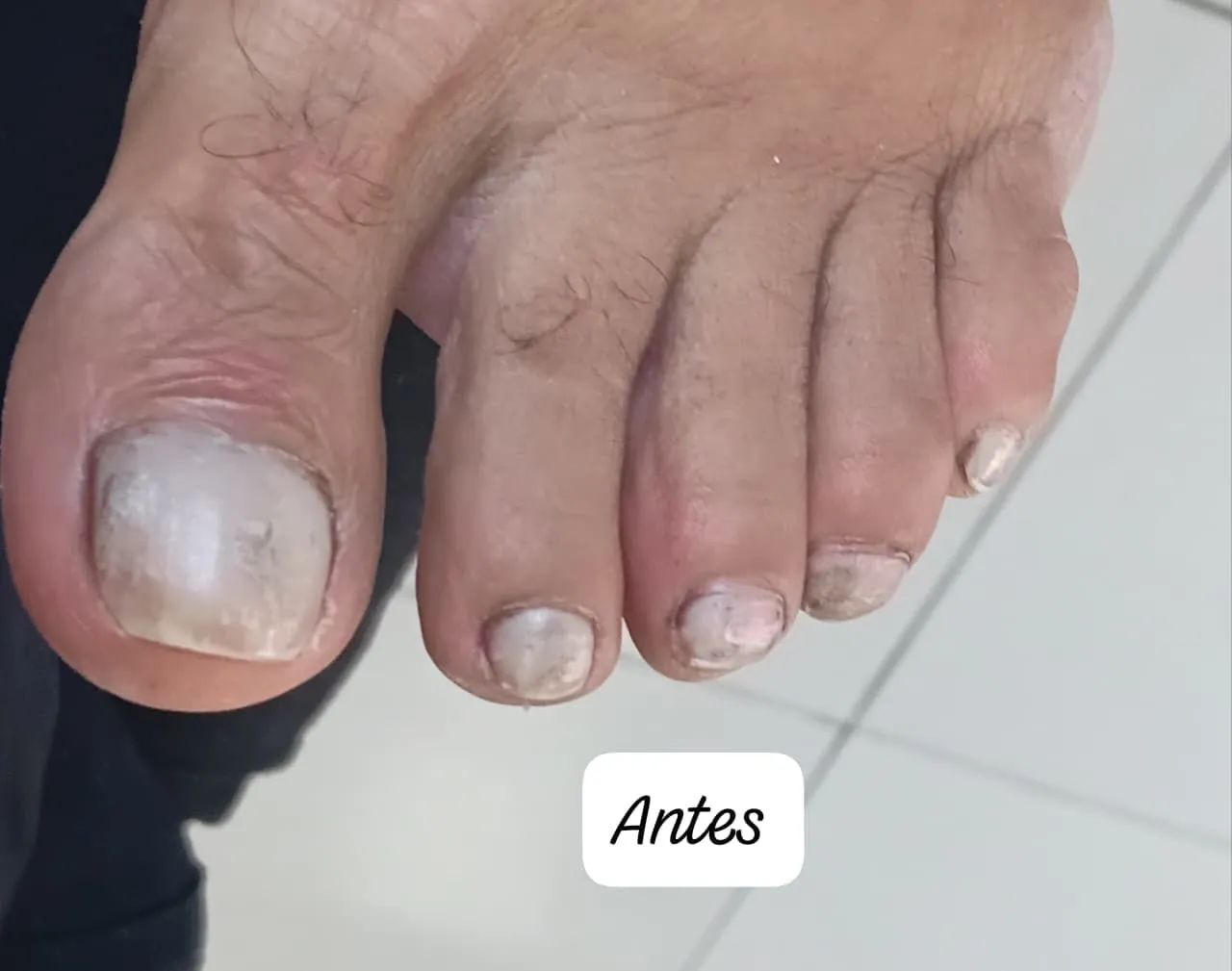 Atendimento Domiciliar Especialista em unhas  - Foto 5