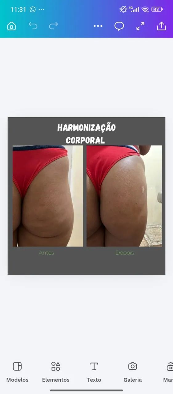 gluteo - Foto 3