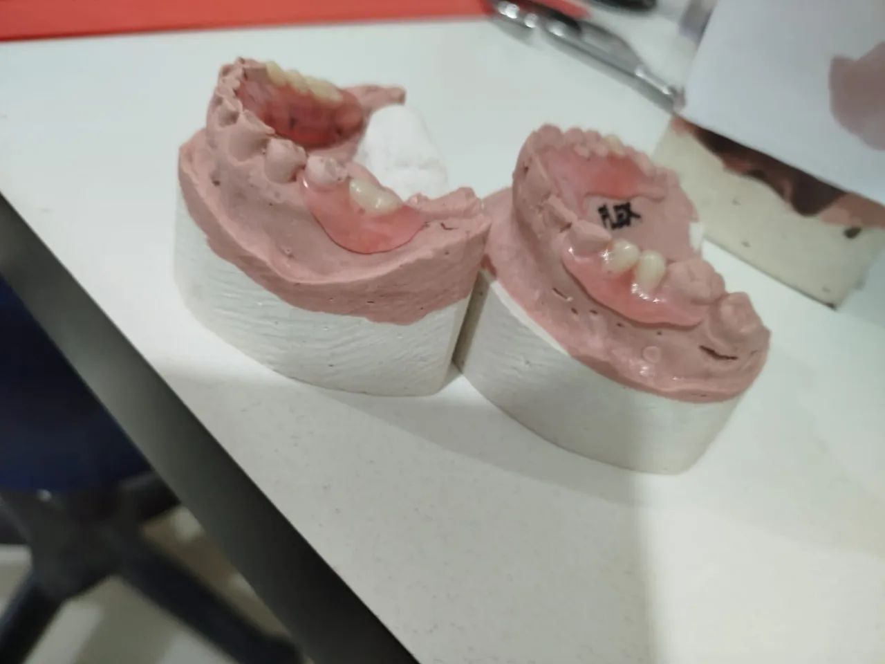 Prótese dentária  - Foto 2