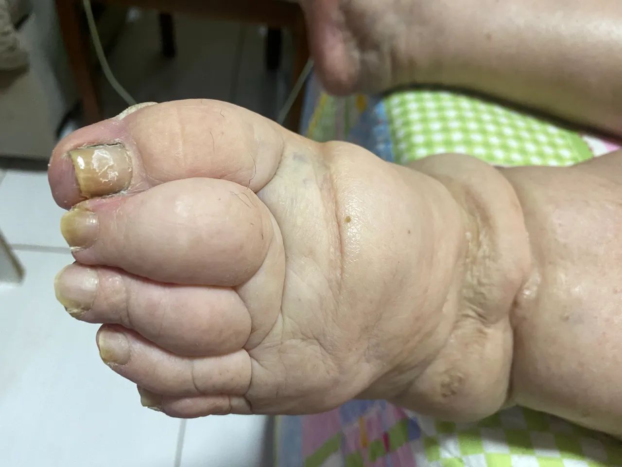 Podologia home care  - Foto 2