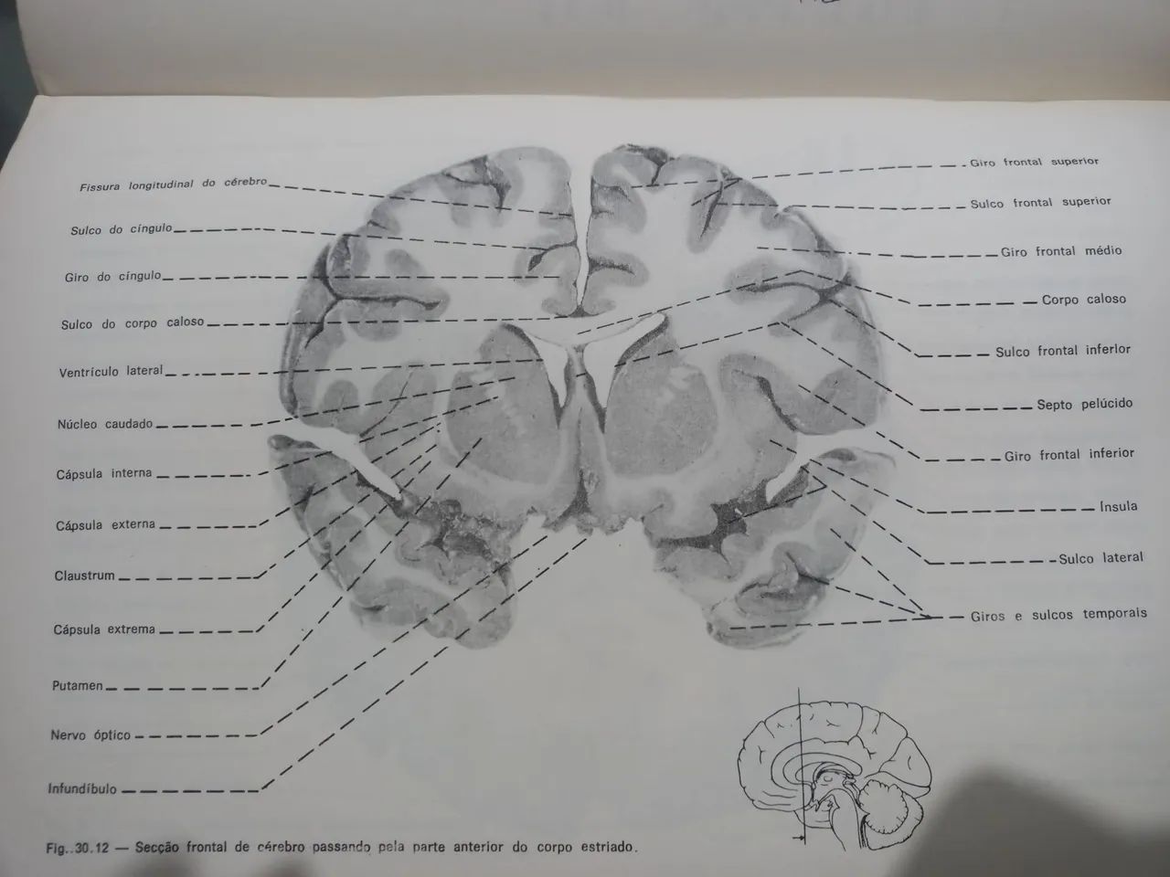 NEUROANATOMIA FUNCIONAL ANGELO MACHADO 1981 - Foto 2