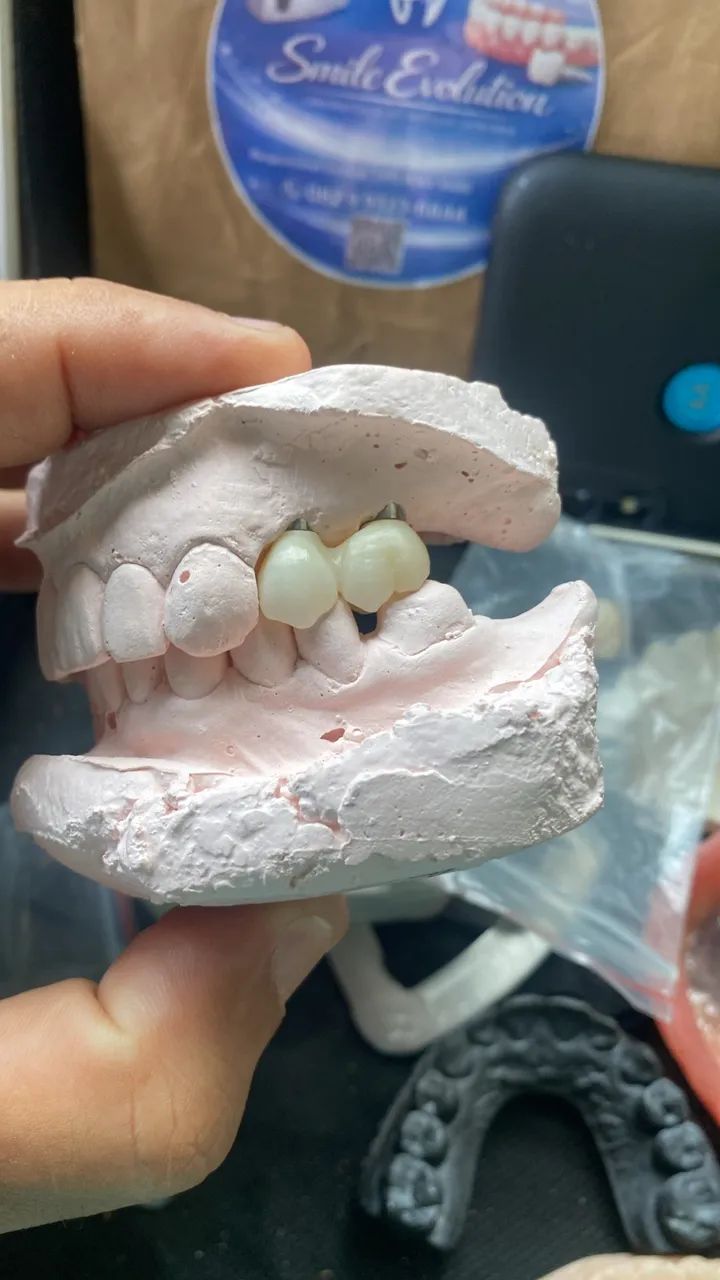 Protese dentaria / dentadura  - Foto 2
