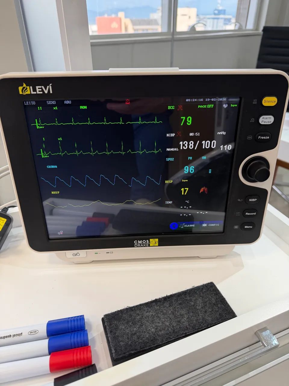 Monitor Cardíaco 12 polegadas