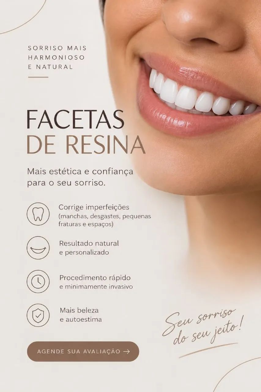 Facetas em resina 