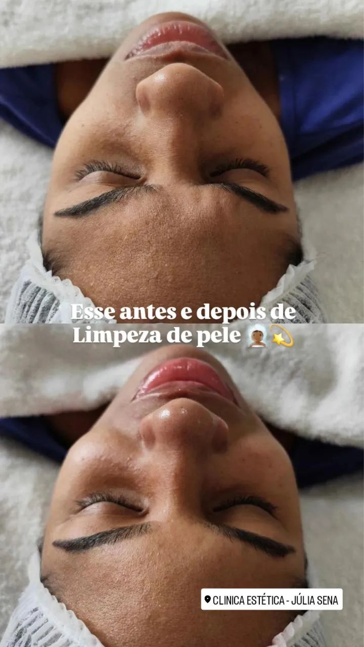 Limpeza de Pele Personalizada  - Foto 2