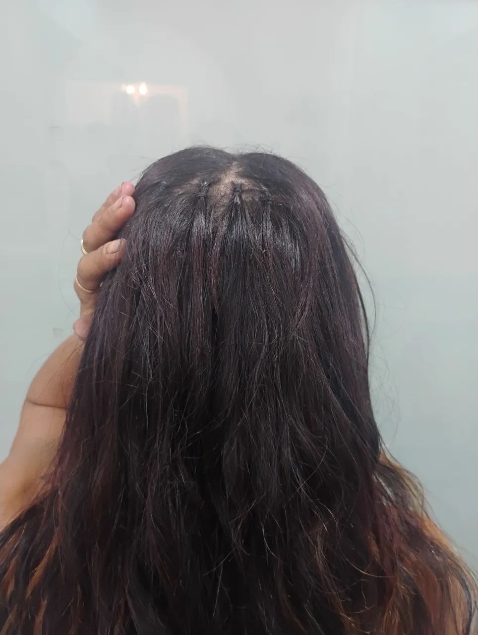 Cabelo e colocação ou só colocação  - Foto 5