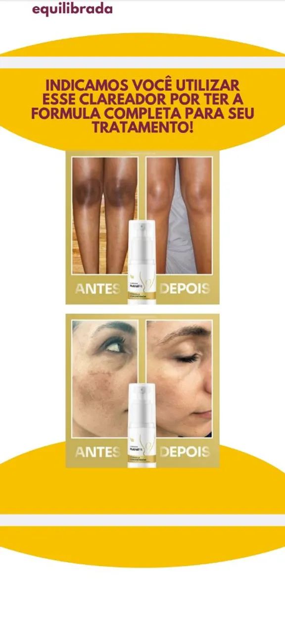 ? Seu novo aliado no cuidado com a pele: conheça o Nutral Fit! ?. - Foto 2