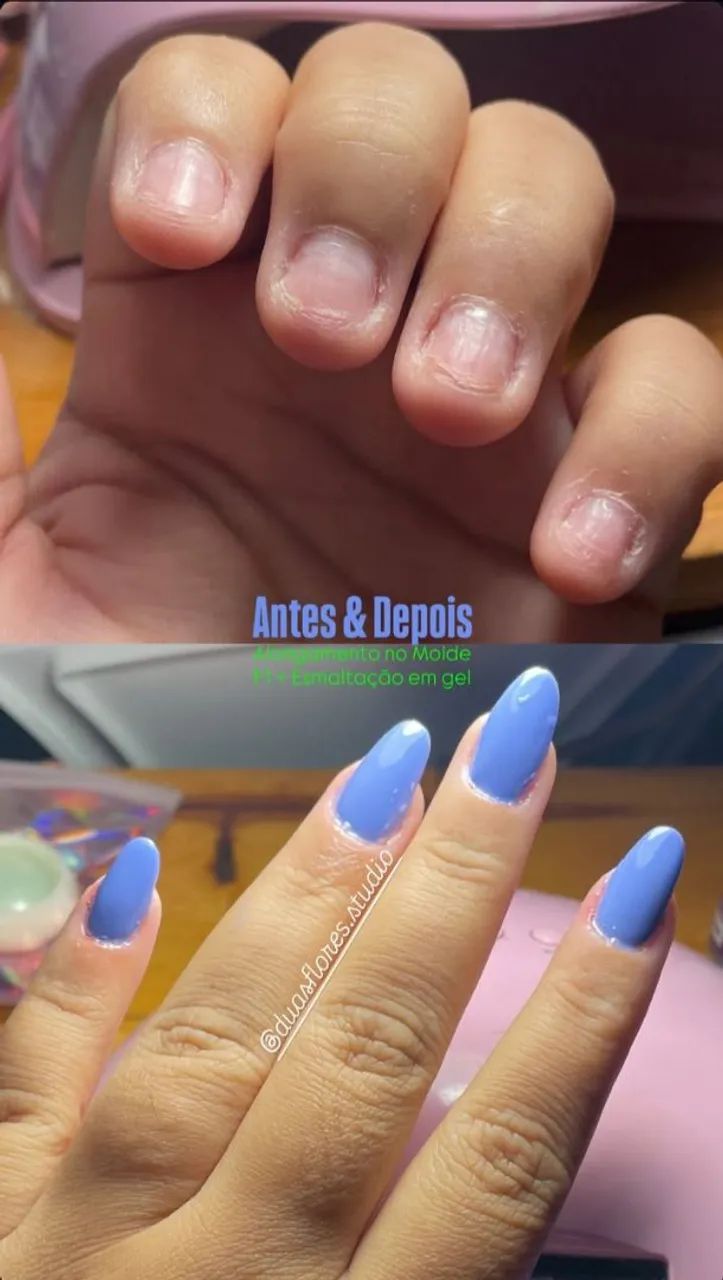 Alongamento em Gel  - Foto 3