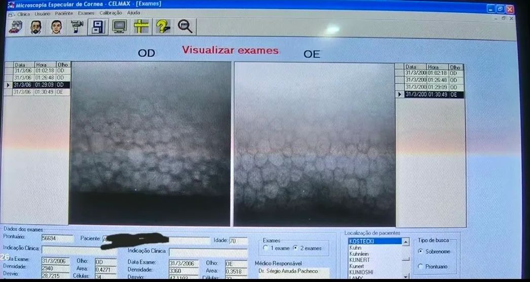 Vendo Microscopio Especular de Córnea  - Foto 2