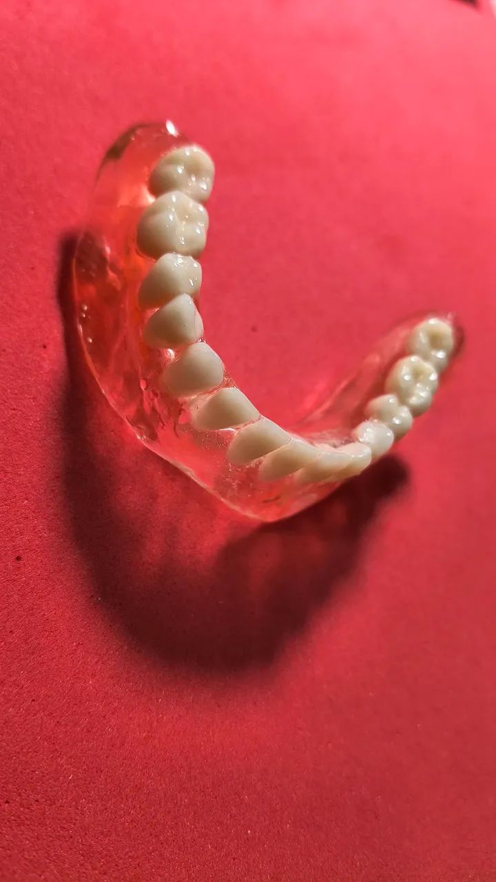 Prótese dentária  - Foto 4