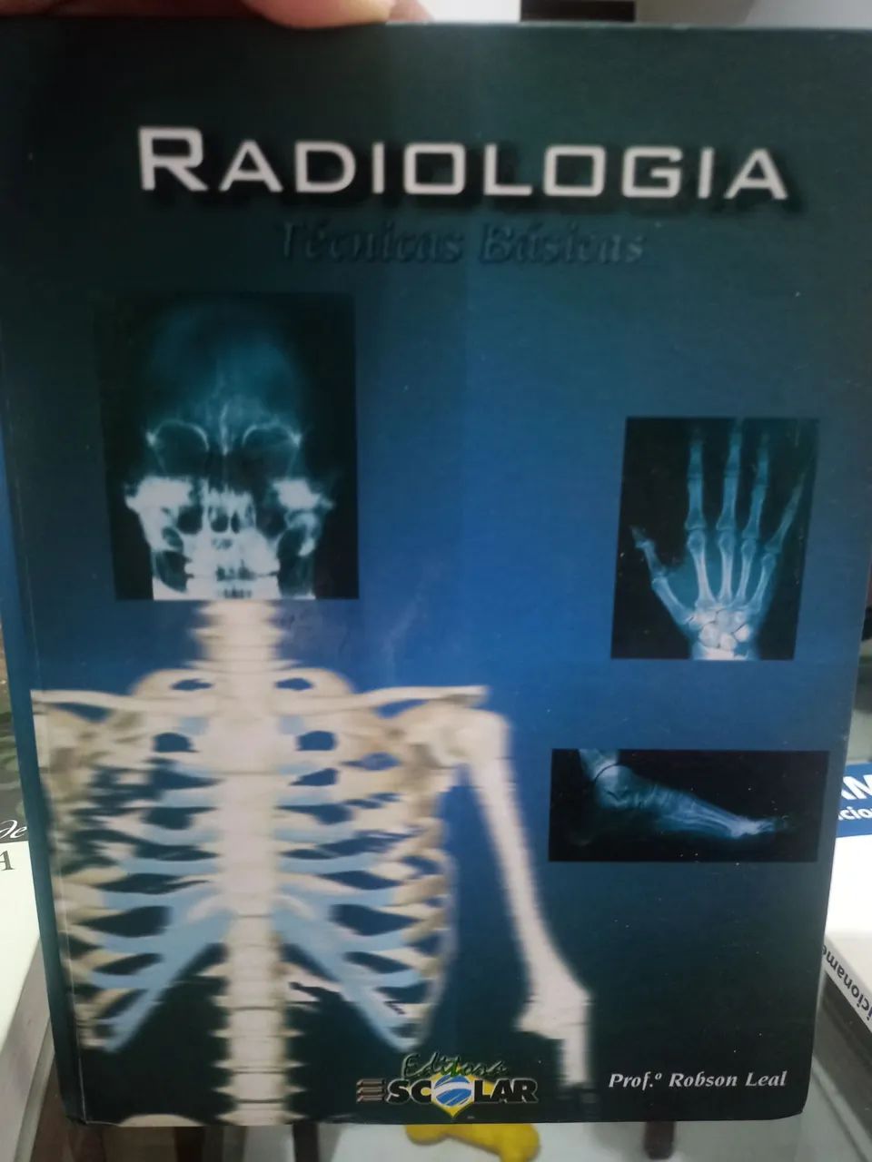 COMBO TRATADO DE RADIOLOGIA, MAMOGRAFIA E RADIOLOGIA TECNICAS PRATICAS - Foto 3