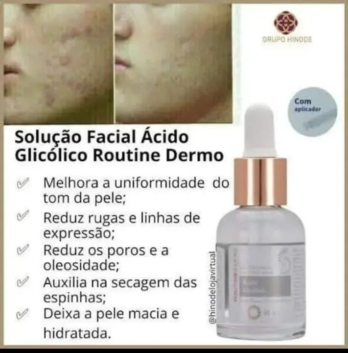 Ácido Glicólico - Renovação e Luminosidade para sua Pele! - Foto 2