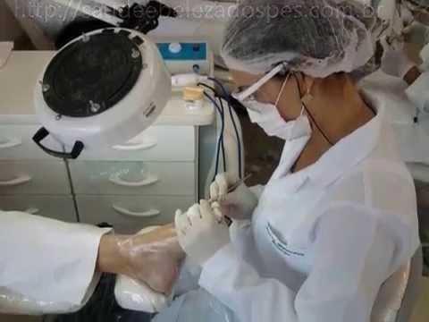 Ligue Podologia- *-whats-Pés-Continente-Florianópolis-Unha-encravada-Podólogo - Foto 2