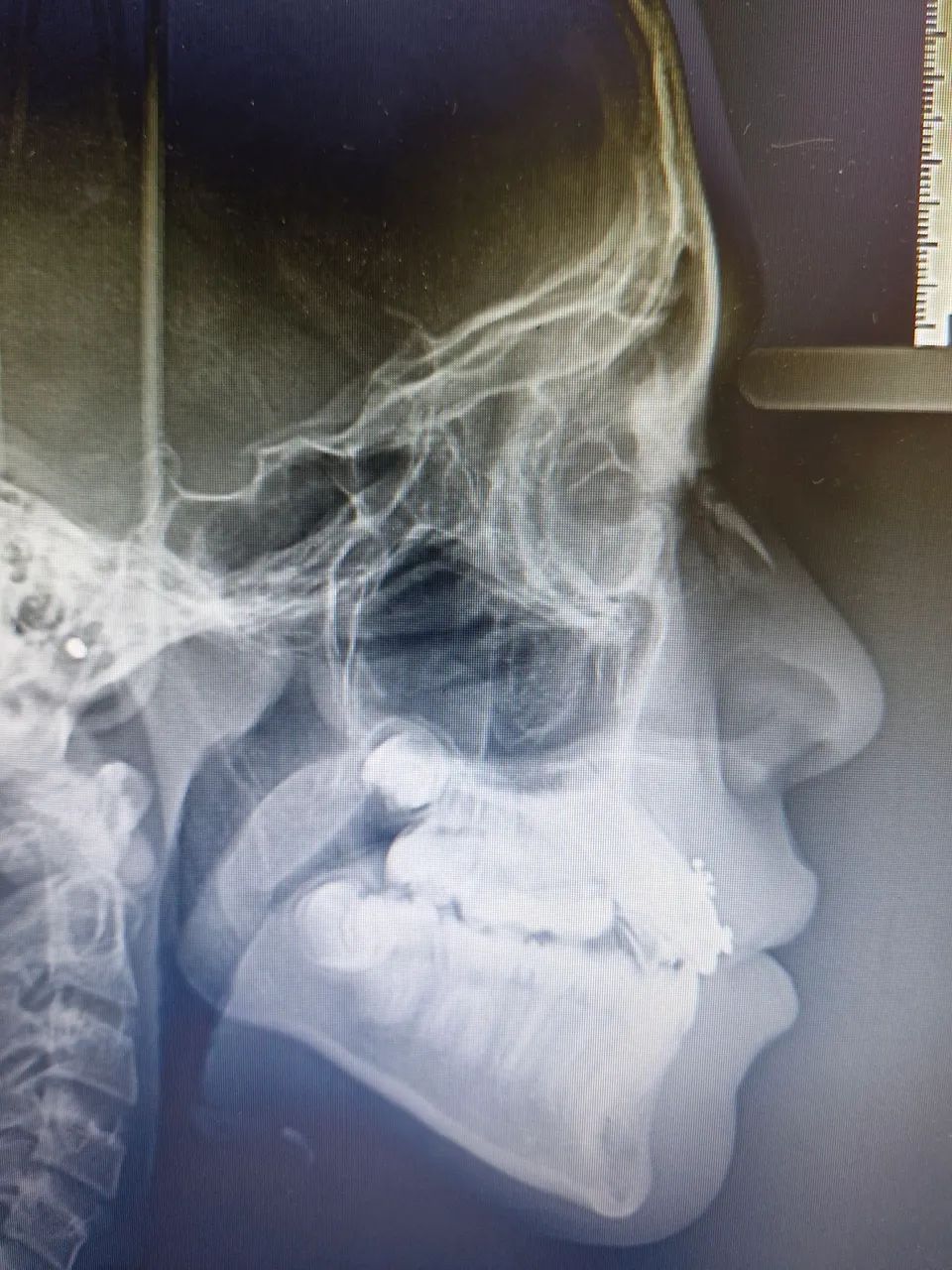 Radiografias odontológicos que cabem no seu orçamento.  - Foto 5