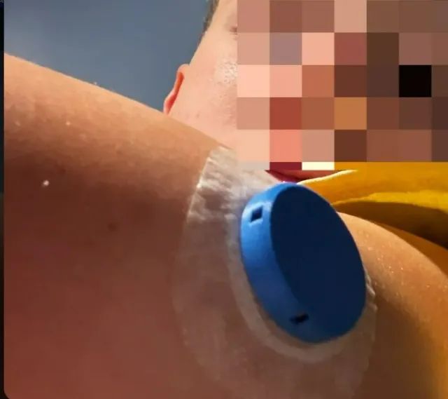 BELTRON Capa protetora para receptor Dexcom G7 - Foto 2