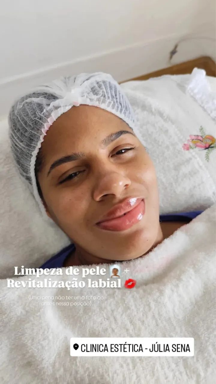 Limpeza de Pele Personalizada  - Foto 4