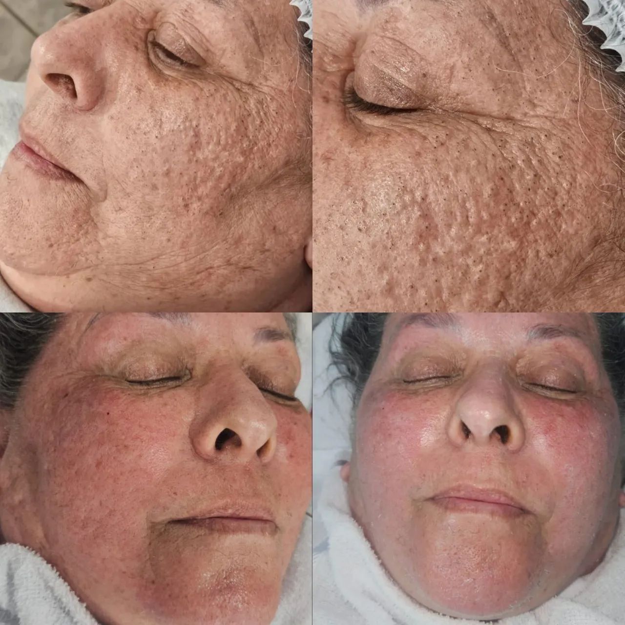 Limpeza de Pele e Depilação a domicílio 