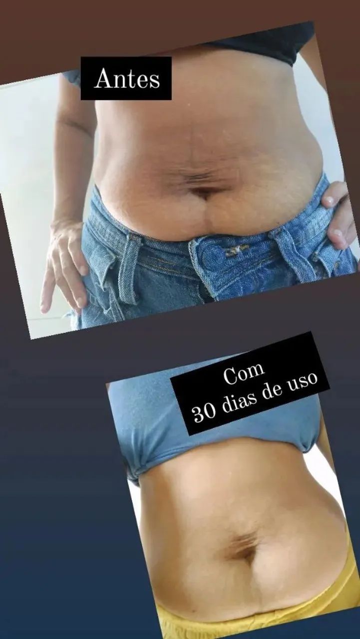 ? Seu novo aliado no cuidado com a pele: conheça o Nutral Fit! ?. - Foto 3