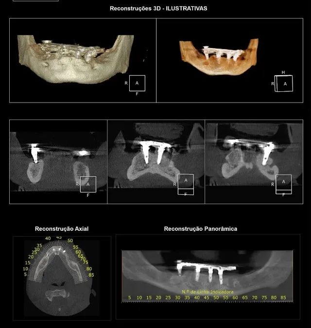 Tomógrafo Odontológico - CONE BEAM - usado - Foto 4