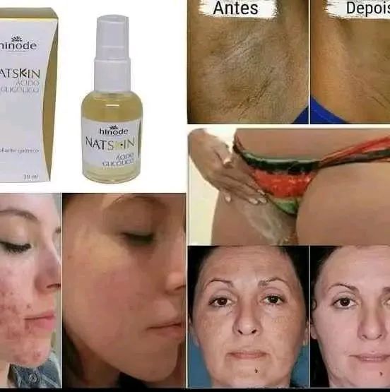 Ácido Glicólico - Renovação e Luminosidade para sua Pele! - Foto 3