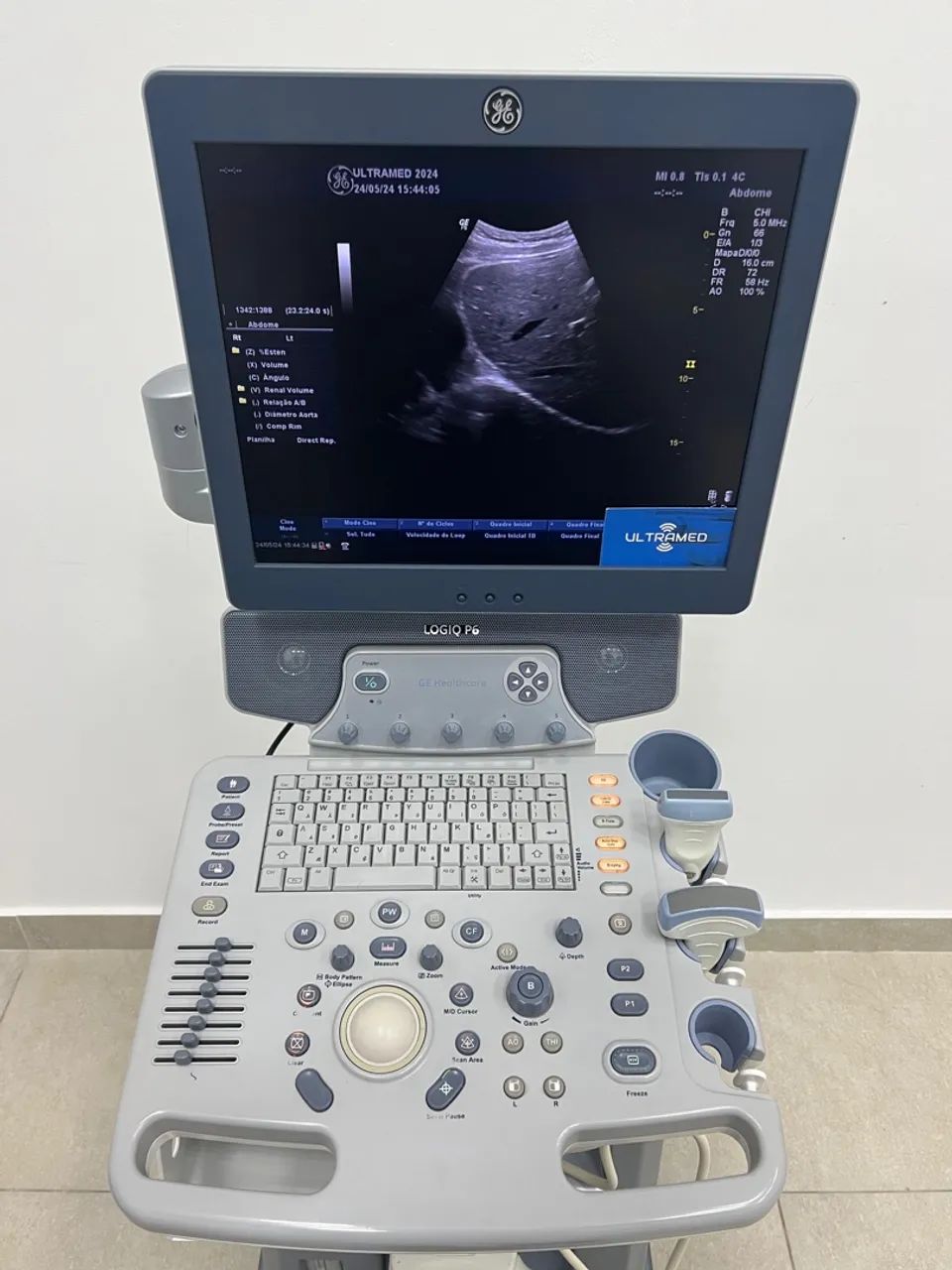 MÁQUINA DE ULTRASSOM PARA ALUGUEL/VENDA - Foto 3