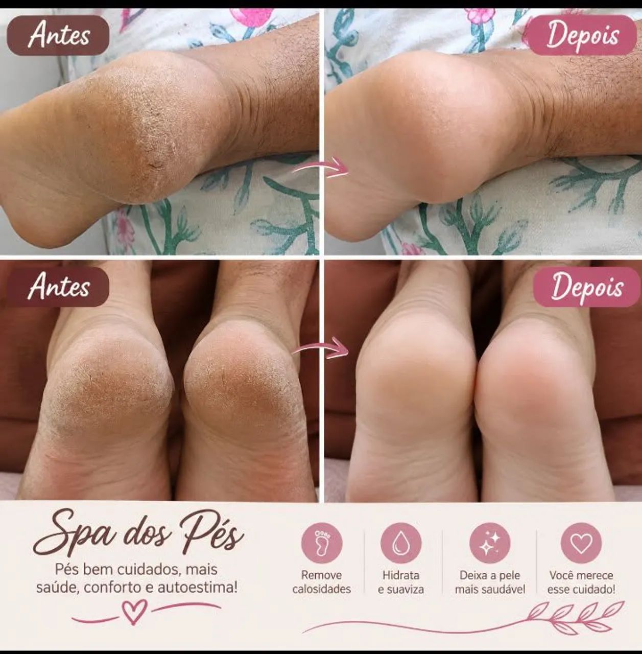 Spa dos pés  - Foto 2