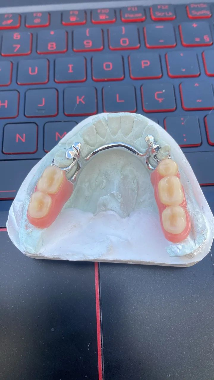 Protese dentaria / dentadura  - Foto 4