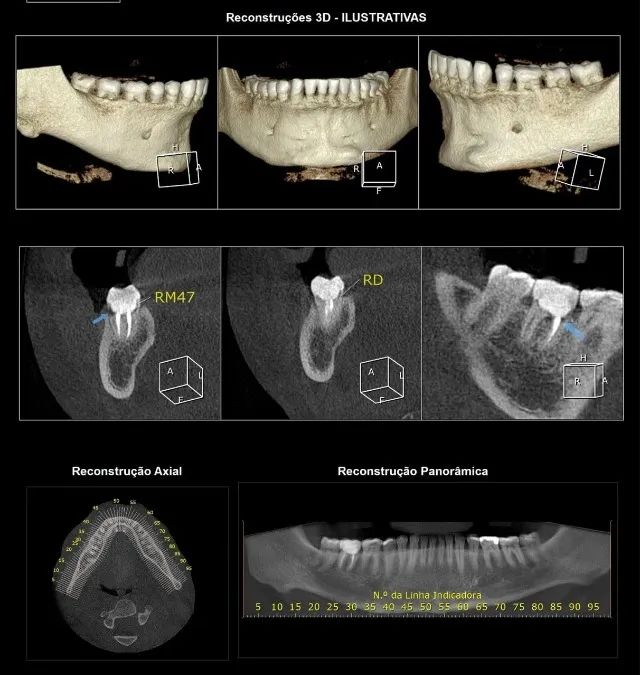 Tomógrafo Odontológico - CONE BEAM - usado - Foto 3