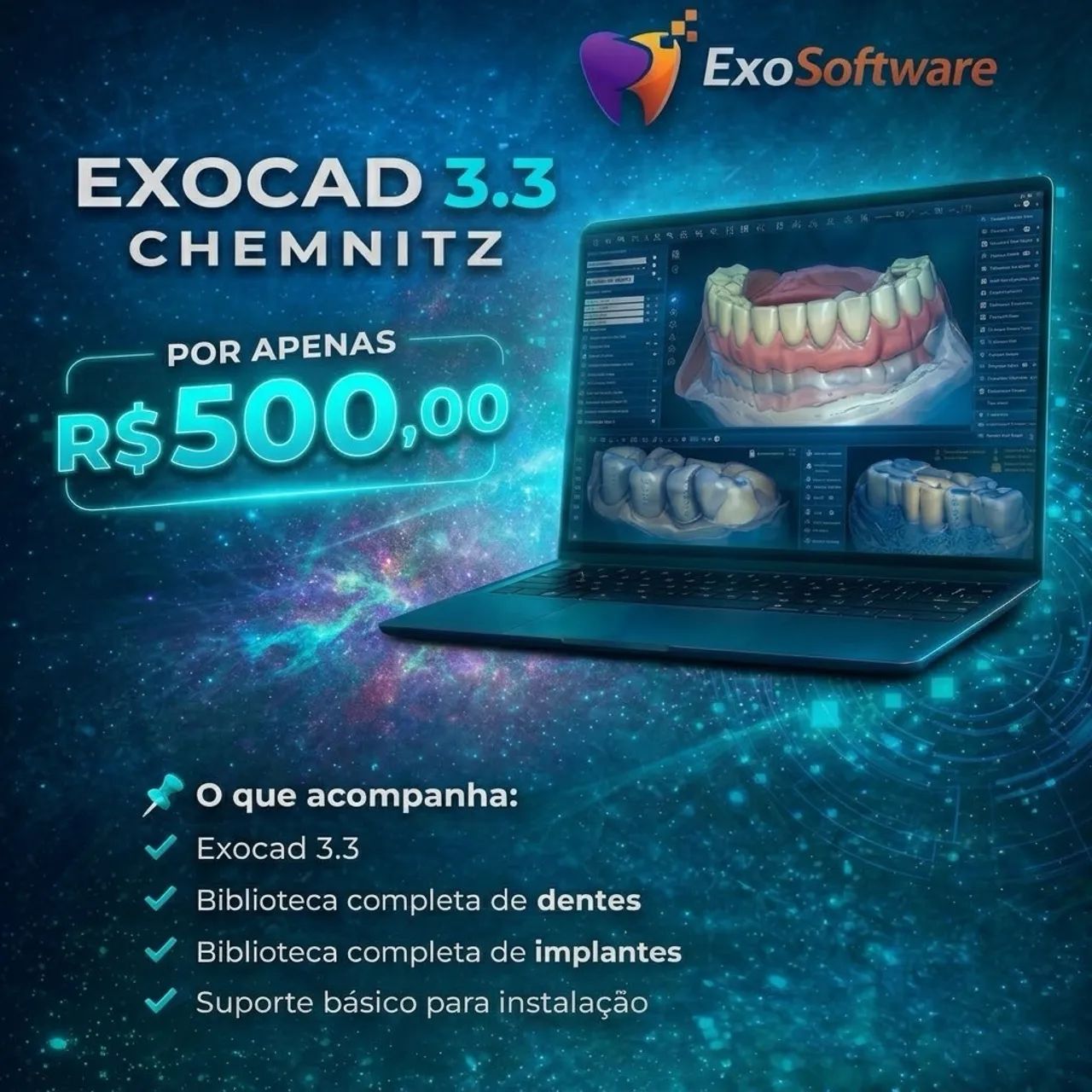 Exocad 3.3 CHEMNITZ + Partial CAD