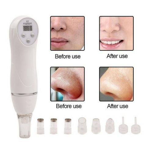 Aparelho Dermoabrasivo com peeling - Foto 3