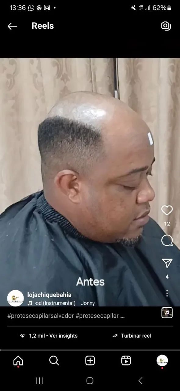 Aplicação, restauração e manutenção de prótese capilar - Foto 5