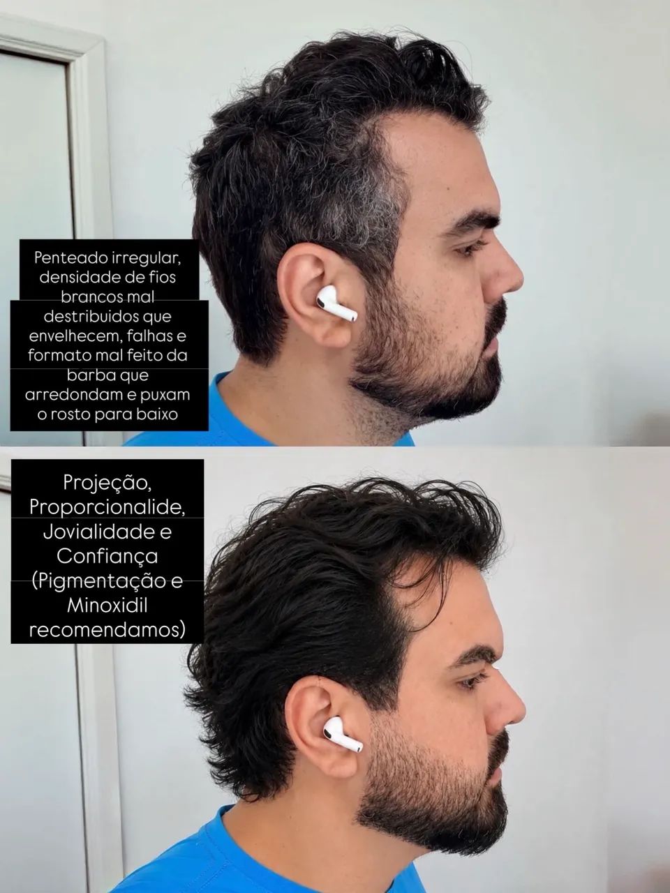 Selagem masculino  - Foto 3