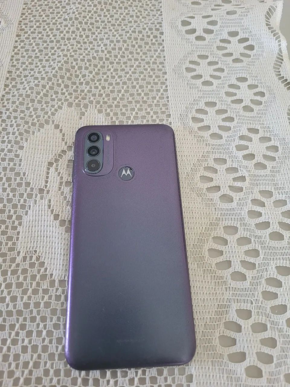 Celular xaomi 11 4g e moto g 31 4g - Foto 3