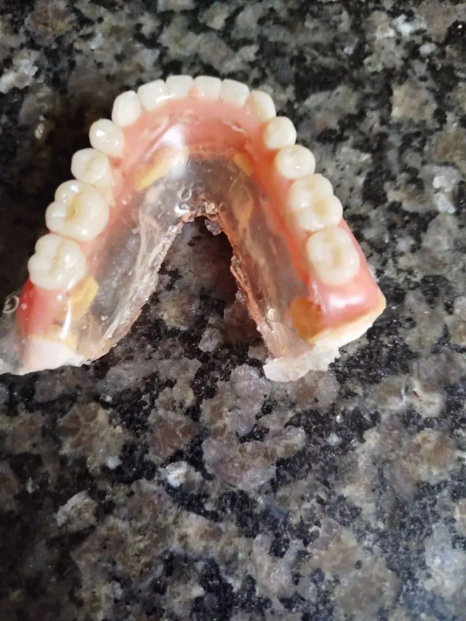 Prótese dentária  - Foto 3