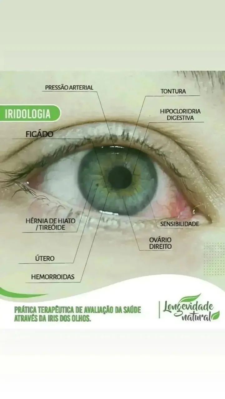 Consultas de Iridologia e Naturopatia!