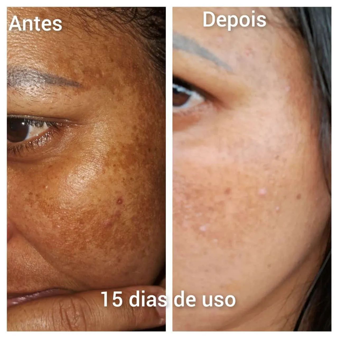 ? Seu novo aliado no cuidado com a pele: conheça o Nutral Fit! ?. - Foto 4