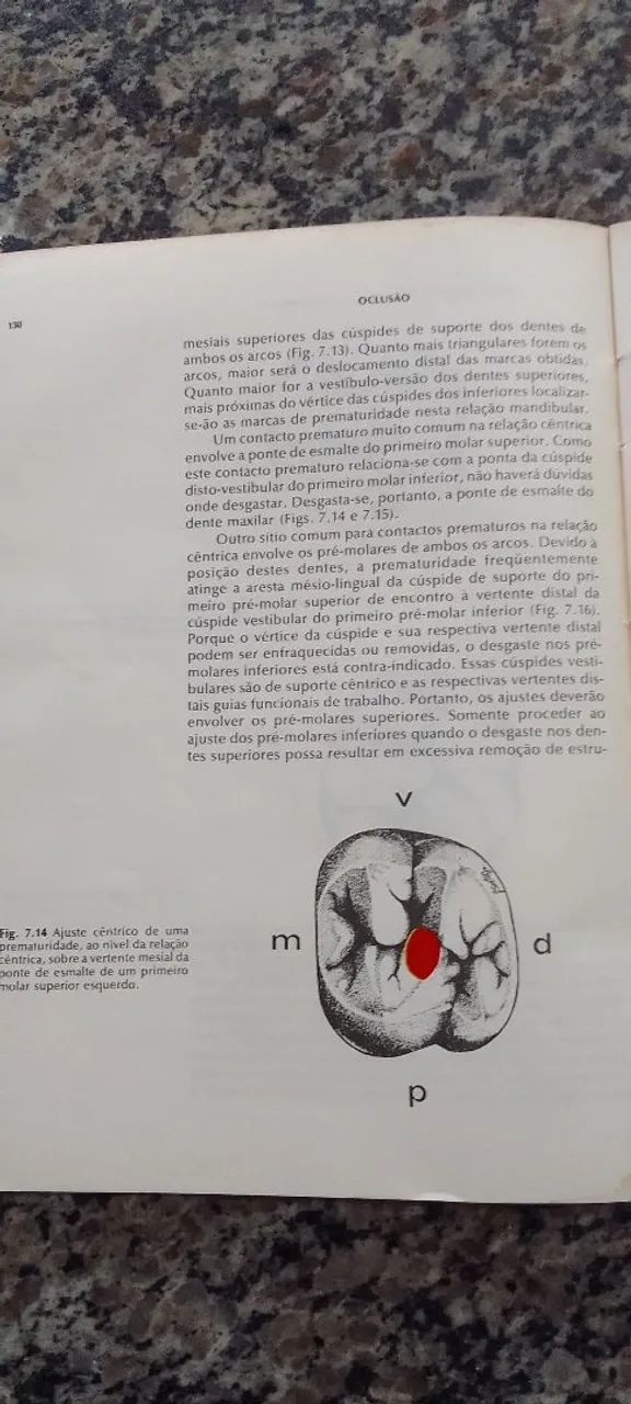 Oclusão fundamentos e conceitos! - Foto 3