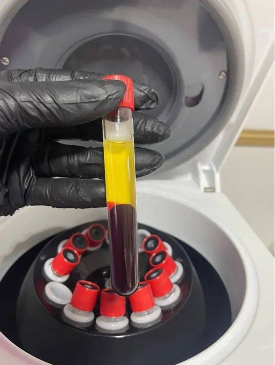 Centrífuga de Laboratório Daiqui DT-4000 - Foto 2