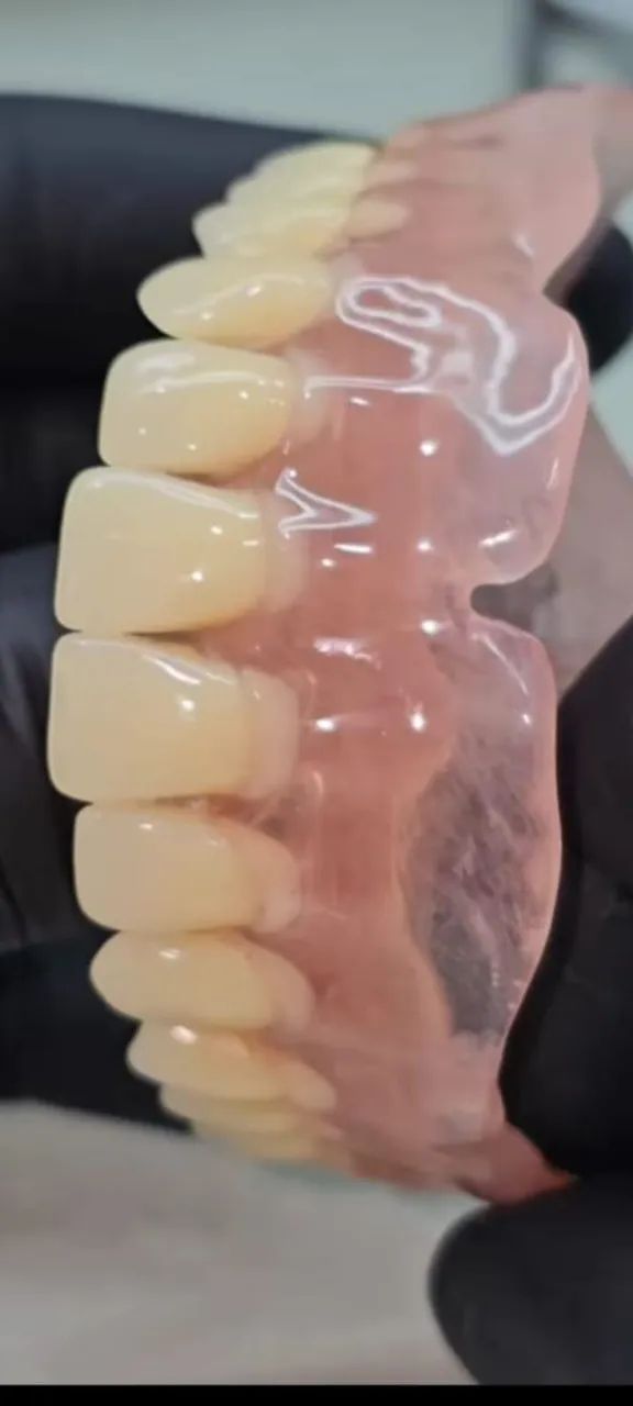 Prótese dentária  - Foto 5