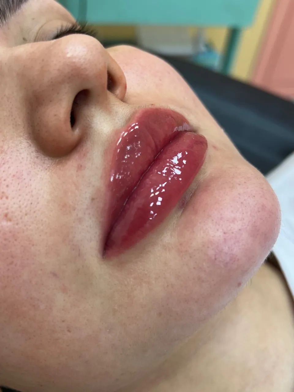 Micro labial 