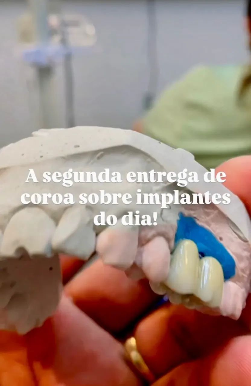 Protese dental (próteses, bride, dentaduras, pererecas, chapas, provisórios, implantes et - Foto 4