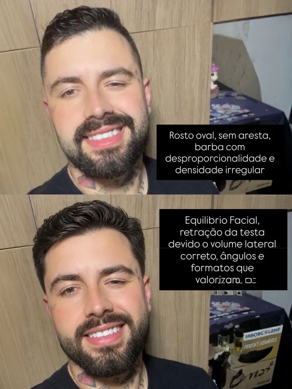 Selagem masculino  - Foto 4