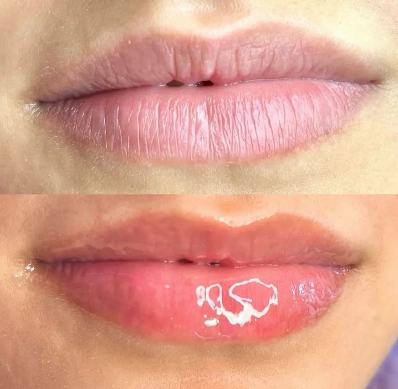Modelos para Hidragloss  - Foto 2