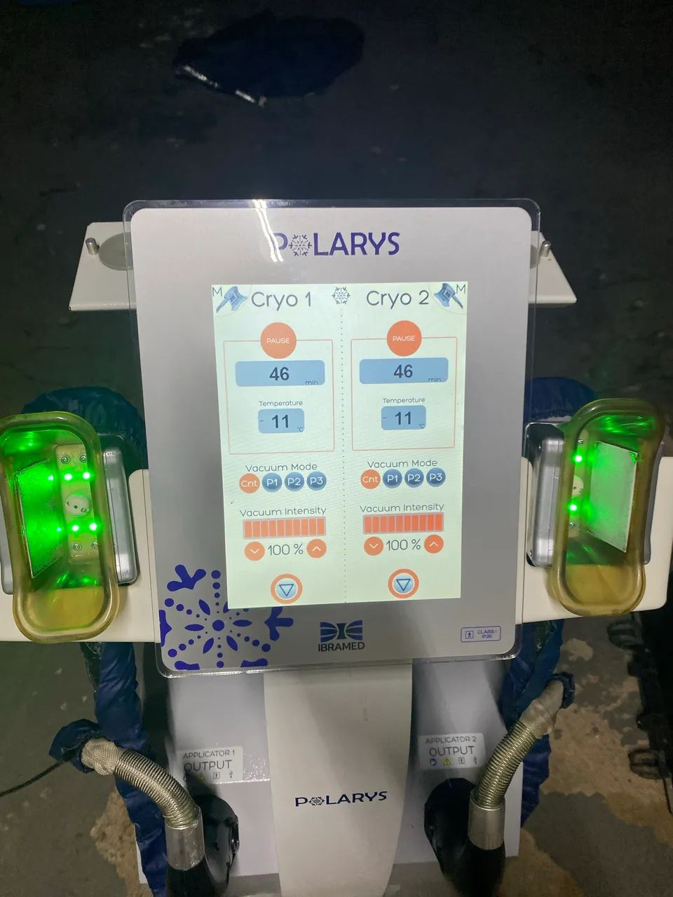 Criolipolise Polarys Ibramed  - Foto 3
